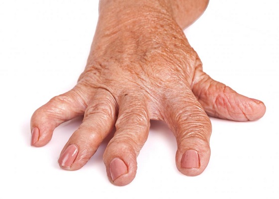 Joint Pain